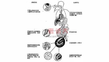 单纯性肠梗阻