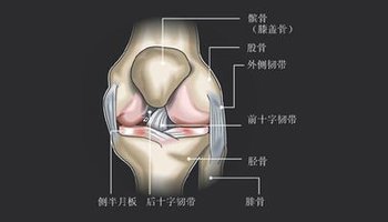 髌骨劳损