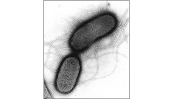 大肠杆菌手绘图