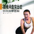 腰椎间盘突出症自我按摩图解