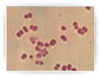 脑膜炎双球菌属奈瑟氏菌属,肾形,多成对排列,或四个相联.