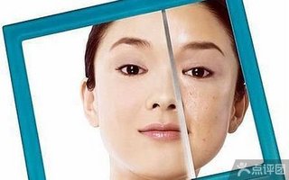 济南市长清妇科门诊部面部淡斑1次