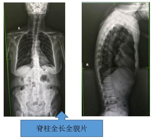 省内首台\＂长骨拼接功能DR照相机\＂在哈市一院投入使用