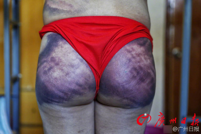 男子见女网友遭非法拘禁 一边被打屁股一边被逼转账