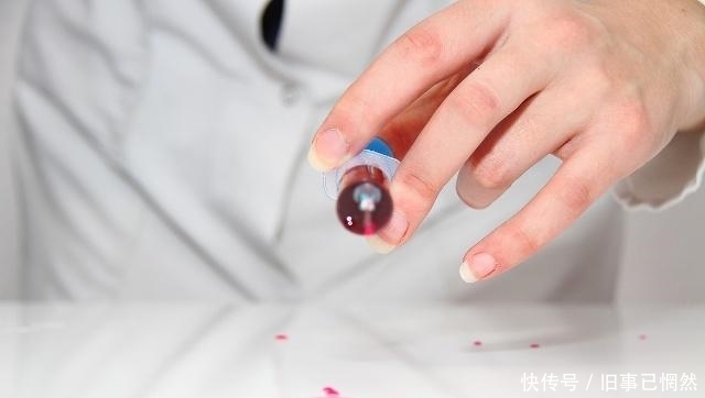 怎么样自己检查艾滋病 t0126e994bcc712fd8d.jpg