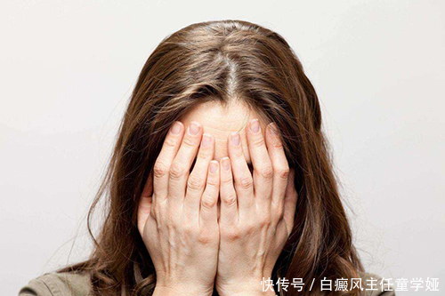 为什么更年期的女性易患白癜风?