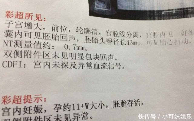 怀孕后,需要做NT检查吗?清楚这件事,对宝宝发