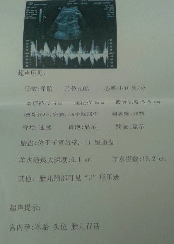 胎儿7个月照B超谁能帮忙分辨男孩女孩?就是想