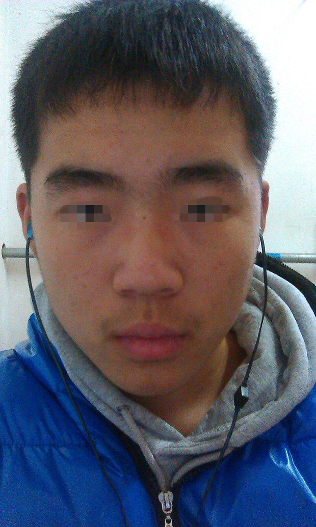 我的鼻子是蒜头鼻么?|已解决问题 - 什么怎么网