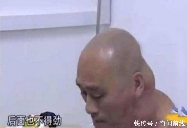 男子酗酒十年，脖子长成河马，医生的一番话让他后悔不已