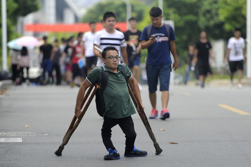 男子幼儿园开始拄拐 靠双手支撑大学梦