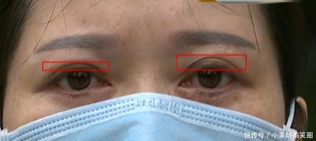 女子坚决要求美容院退费赔偿老公说越来越难看