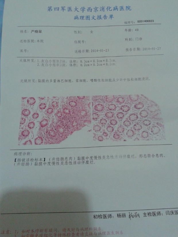 结肠息肉病理报告:(升结肠息肉)黏膜中度慢性炎急性活动伴糜烂,形态