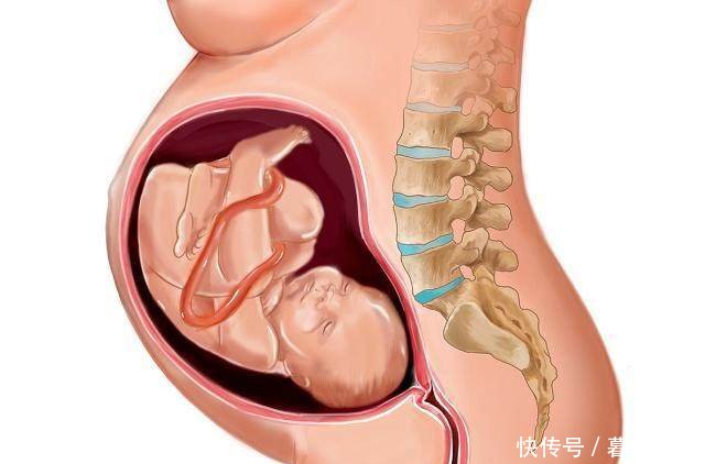 过了预产期胎儿却不入盆孕妈坚持这样做,宝宝