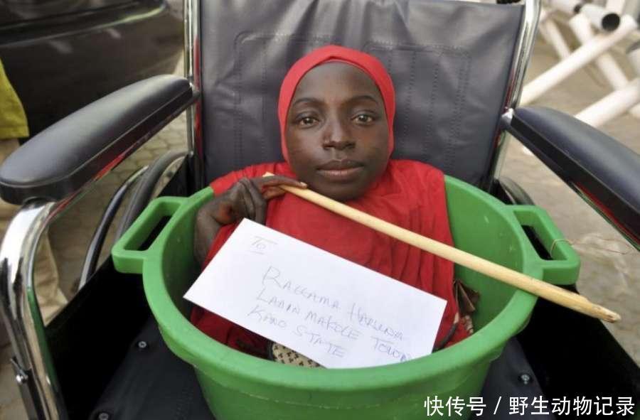 十九岁女孩身患怪病全身截肢仅剩头部依然坚强活着，网友：奇迹