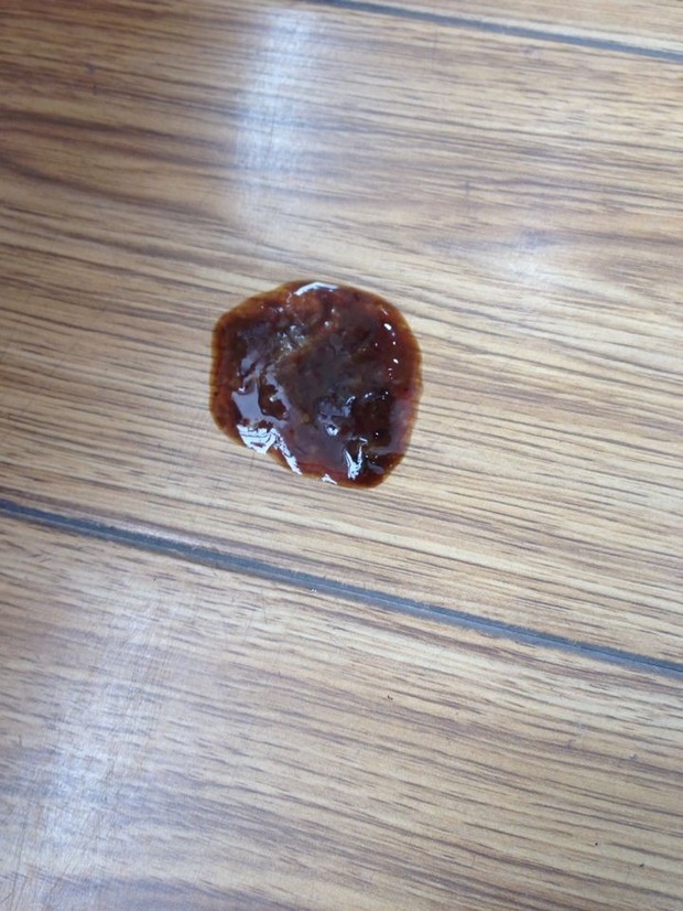 泰迪细小治疗4天后吐水,大便不成形要紧吗