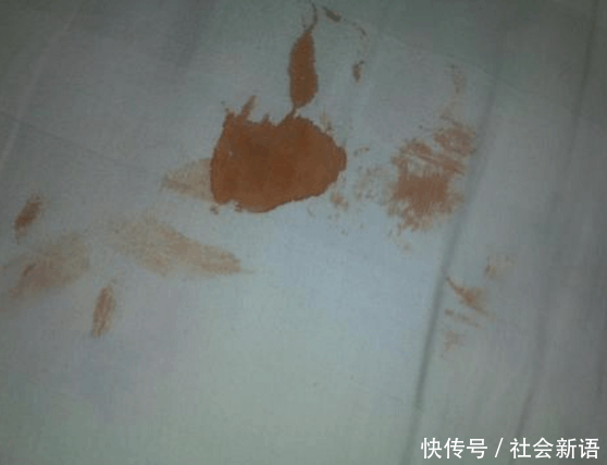 男子一觉醒来发现下半身有血, 到医院检查, 检查