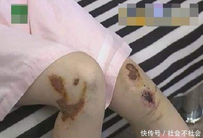 外卖小哥骑车撞人,不救人反而狂言:我有保险撞