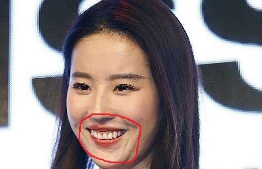 明星身上的缺陷,刘亦菲的大肉牙,而她居然有1