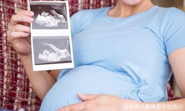 胎儿入盆为何是头朝下?这样的姿势胎儿真的舒