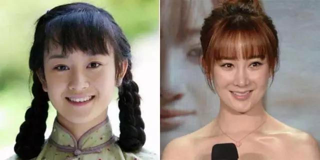 娱乐圈那些大方承认整容的女明星们，戚薇坦荡，郑爽可惜，而她算是整残了