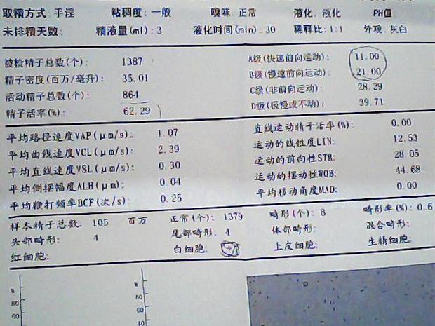 各位良医请帮我看看这精液及精子质量的分析结果.