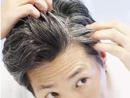 这三个位置长白发 暗示肝不好 - 钟儿丫 - 响铃垭人 这三个位置长白发 暗示肝不好 - 钟儿丫 - 响铃垭人