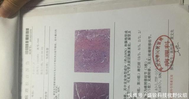 直面奥迪车主不只是白血病还有肺癌,家属称要