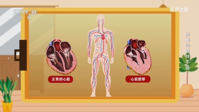 《健康之路》 20251212 你离心衰并不远