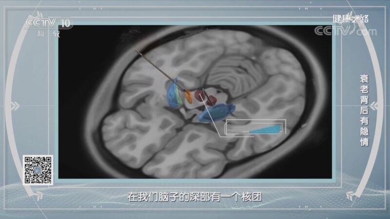 健康之路 《健康之路》 20200911 衰老背后有隐情