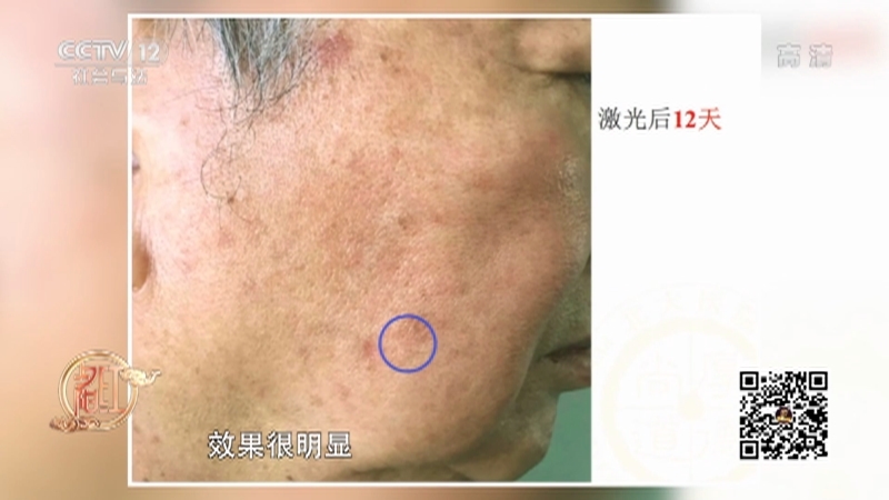 《夕阳红》 20210805 时尚全知道——容颜不老有妙招