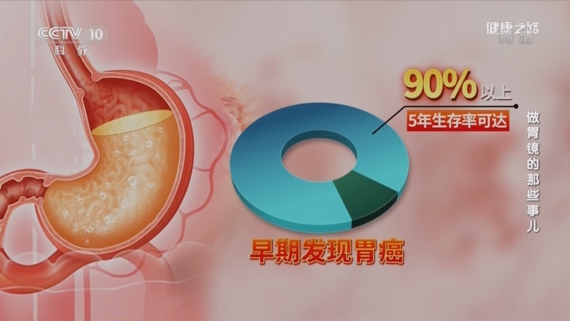 健康之路 《健康之路》 20220608 做胃镜的那些事儿
