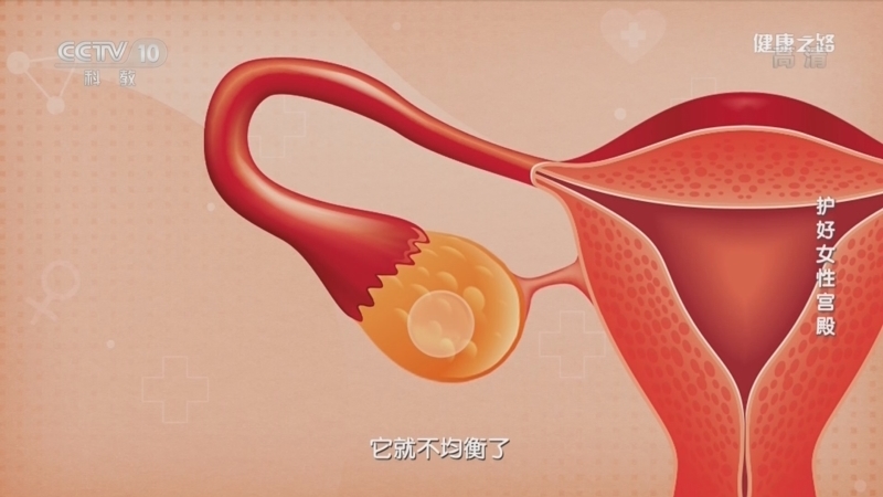 健康之路 《健康之路》 20220329 护好女性宫殿