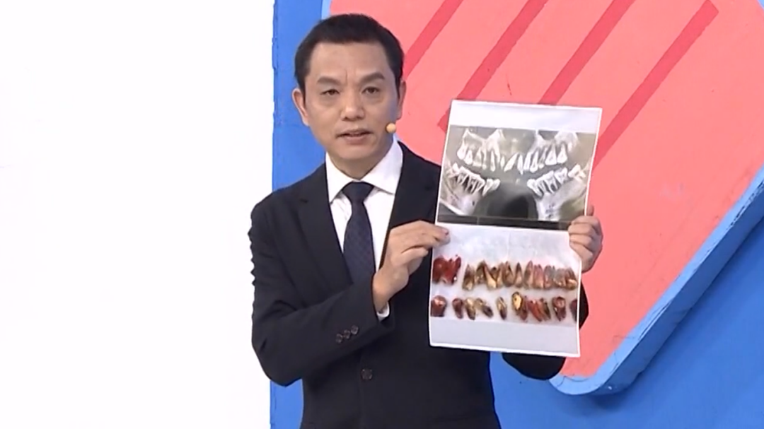 X诊所. 当基础病和牙病“狼狈为奸”该如何招架