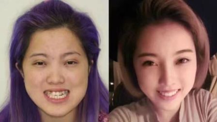 咋整呢呵呵 第二季 来自中国的整脸大师 一年为300多个姑娘改头换面