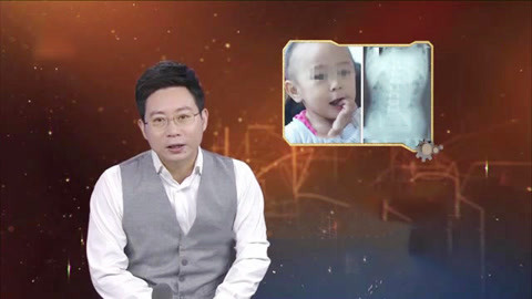 经典传奇 肚里“长”钉子的女孩 警方出马能否揭开谜底