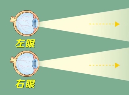 新闻大求真 两眼视力不一样会有什么影响？