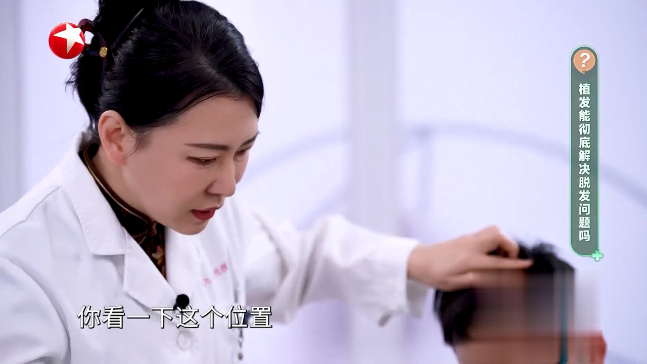 快闪医院——植发能彻底解决脱发问题吗