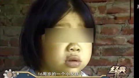 经典传奇 怪病解码 天山童姥 18岁女孩长相跟4岁孩子一样