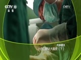 走近科学 《走近科学》 20161117 小创口解决大麻烦（下）