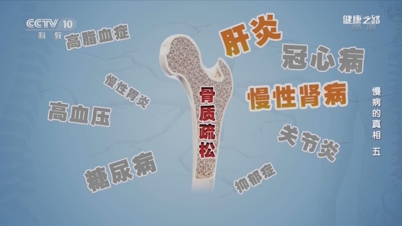 健康之路 《健康之路》  20221217 慢病的真相（五）