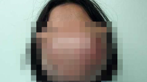 涨健识 美女患怪病脸部变“马脸”
