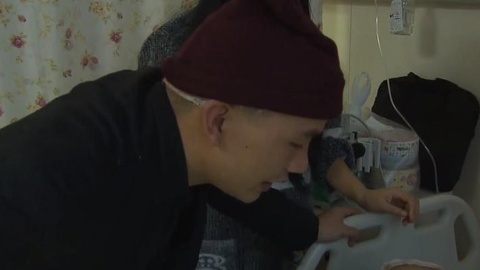 播报多看点 2岁孩童重度烫伤 父亲割头皮救子