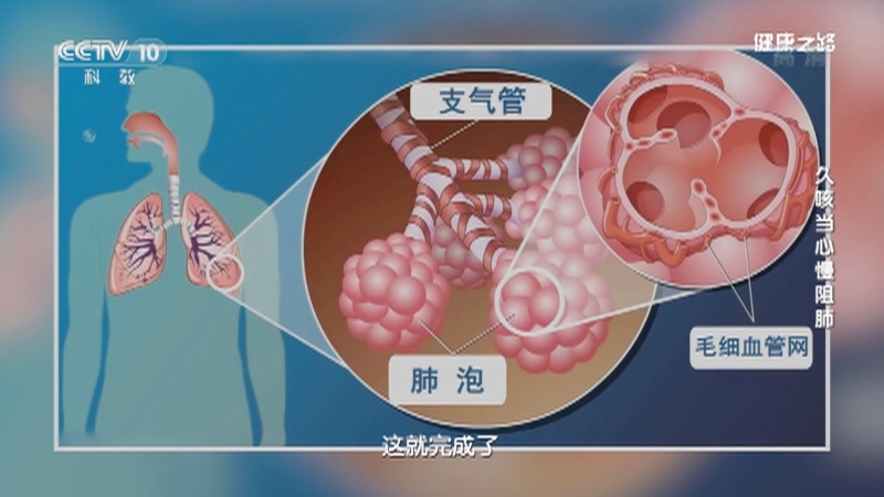 健康之路 《健康之路》 20201218 久咳当心慢阻肺