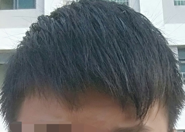 青少年男生头发少细软适合剪什么发型