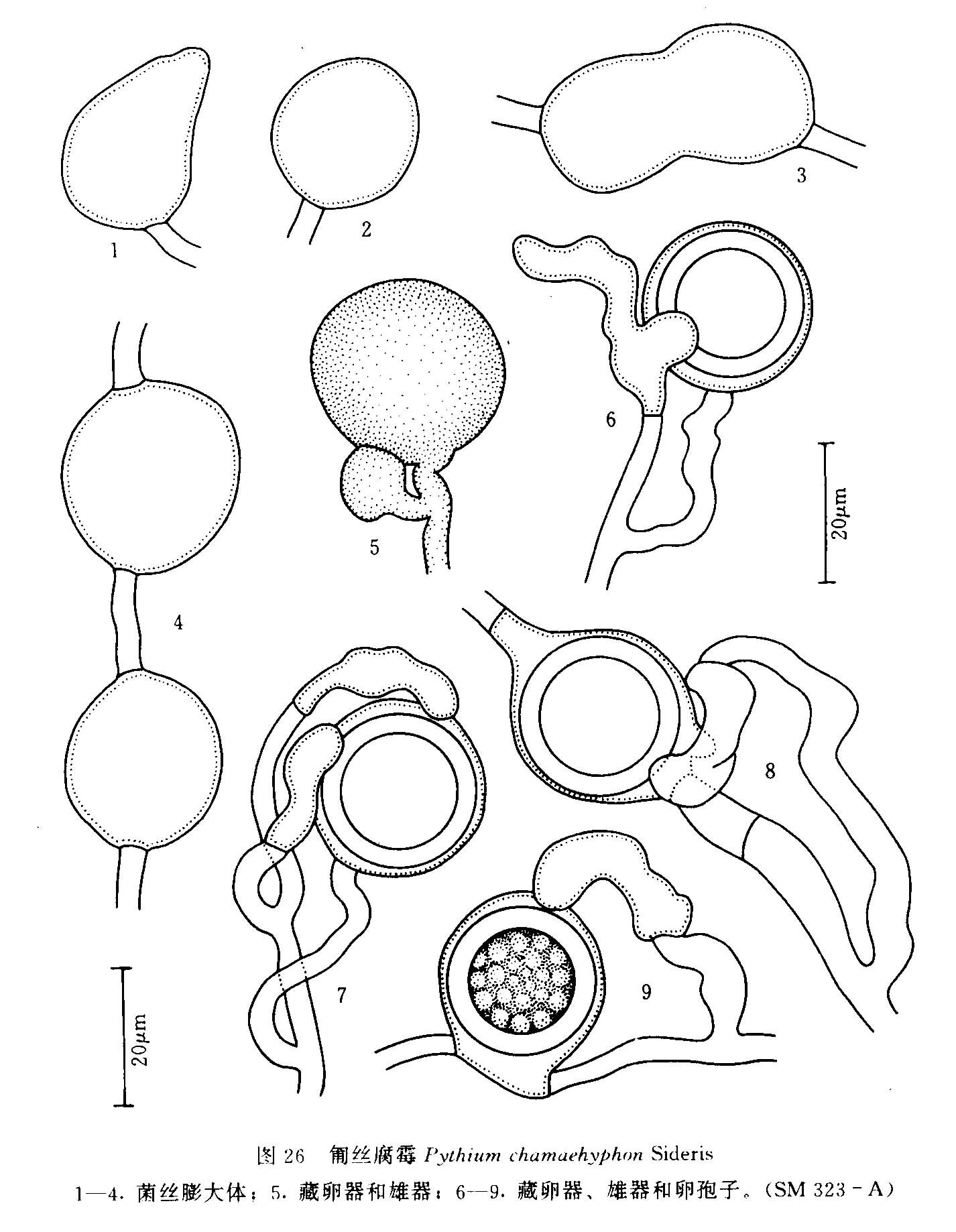 颈卵器手绘图图片