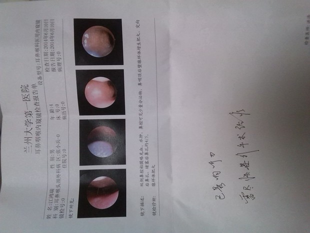 7歲娃腺樣體大面容照片 腺樣體肥大手術保險給報嗎