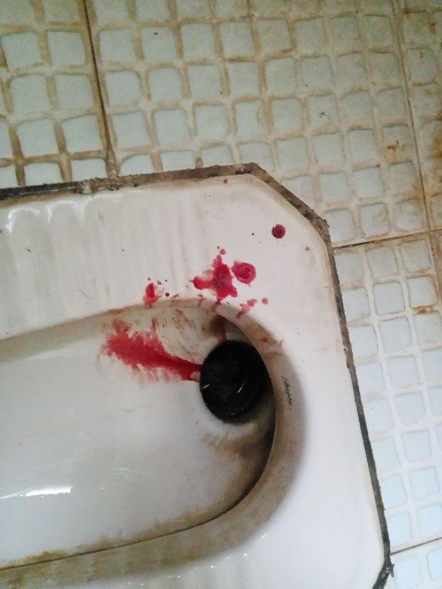 吐血厕所图片