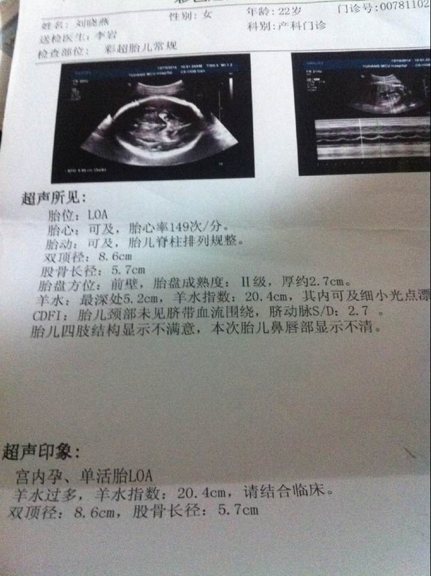 孕期羊水指数对照表(孕期羊水指数对照表29周)-第2张图片-鲸幼网